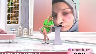 Esra Erol ifşa videoları part 11 - Turkunlu üzerinde izle