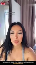 Mico Mina Estetik Suratı Yapanı | turkifsatube Ön İzleme